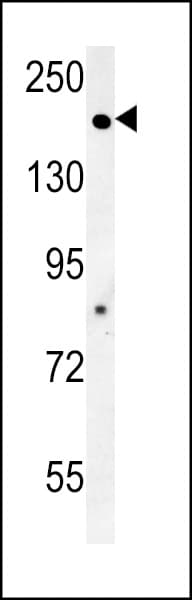 Polyclonal Rabbit anti-Human ADCY10 / Adenylate Cyclase 10 Antibody (aa557-583, WB)