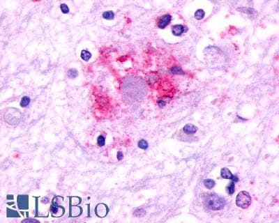 PathPlus™ GRM2 / MGLUR2 Antibody (N-Terminus)