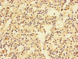 Polyclonal Rabbit anti-Human PDIK1L Antibody