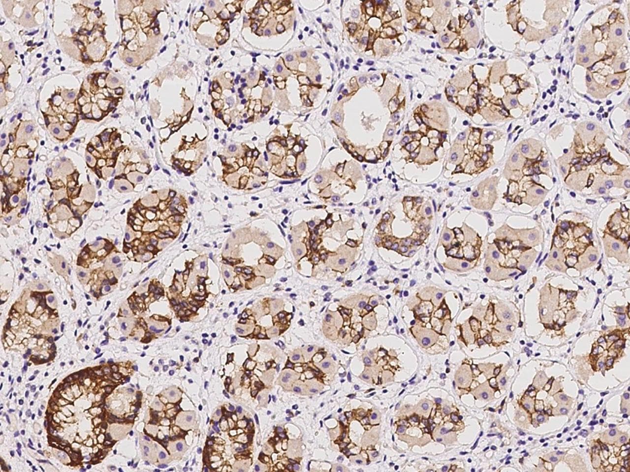 MLPH / Melanophilin Antibody