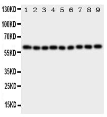 Polyclonal Rabbit anti-Human IL5RA / CD125 Antibody (aa53-68, WB)
