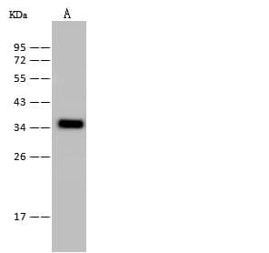 PSMD14 Antibody