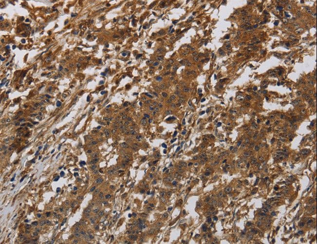 ITGB7 / Integrin Beta 7 Antibody