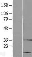 CYHR1 Protein (Over-Expression Lysate Myc-DDK (Flag))