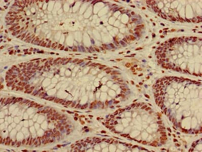 HIST1H3A Antibody