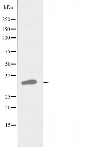 RASD2 Antibody