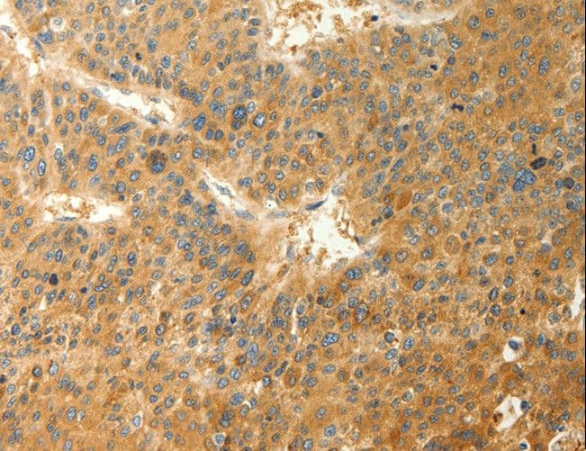 RAB35 Antibody