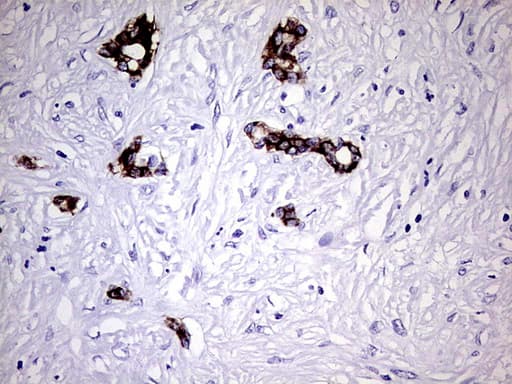 KRT7 / CK7 / Cytokeratin 7 Antibody (aa1-114, clone UMAB161)
