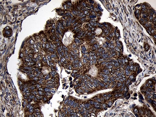 AIFM1 / AIF / PDCD8 Antibody (aa134-483, clone OTI4E6, Carrier-free)