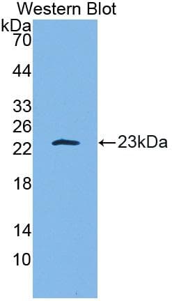IL-10 Antibody (aa19-178)