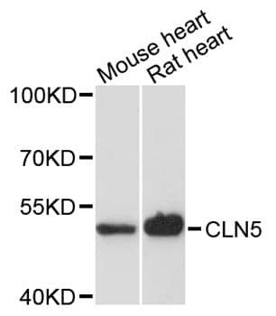 Polyclonal Rabbit anti-Human CLN5 Antibody (WB)