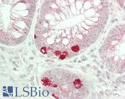 IHC-plus™ RPS12 / Ribosomal Protein S12 Antibody (aa76-125)
