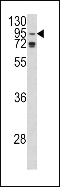 IHC-plus™ Polyclonal Rabbit anti-Human AGO1 / EIF2C Antibody (aa27-56, IHC, WB)