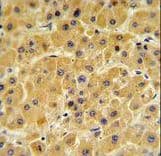 Polyclonal Rabbit anti-Human F10 / Factor X Antibody (aa351-381, IHC, WB)