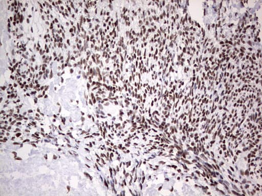 HDAC9 Antibody (aa181-460, clone OTI7G2, Carrier-free)