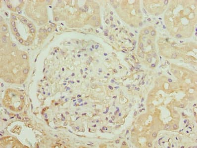 CCR1 Antibody