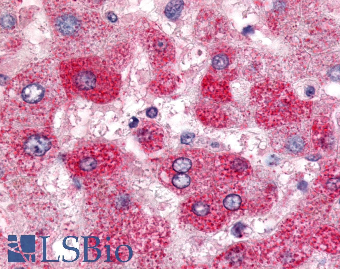 PathPlus™ SGK2 Antibody (Internal)