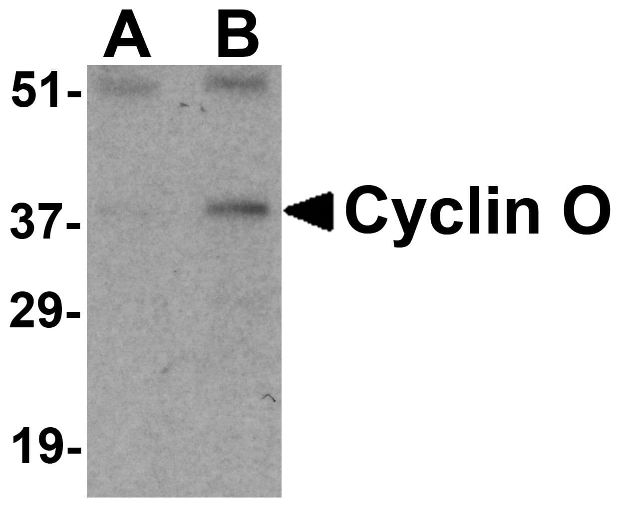 IHC-plus™ Polyclonal Rabbit anti-Human CCNO / UNG2 Antibody (IHC, WB)