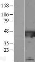 CATIP / C2orf62 Protein (Over-Expression Lysate Myc-DDK (Flag))