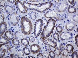 Monoclonal Mouse anti-Human CDH1 / E Cadherin Antibody (clone OTI2F9, IHC, WB)