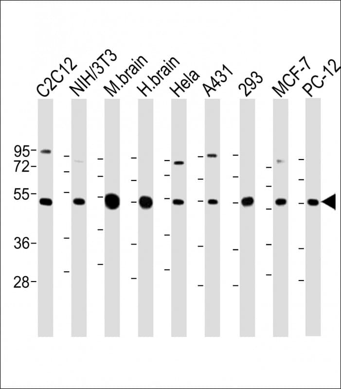 TUBB2A / Tubulin Beta 2A Antibody