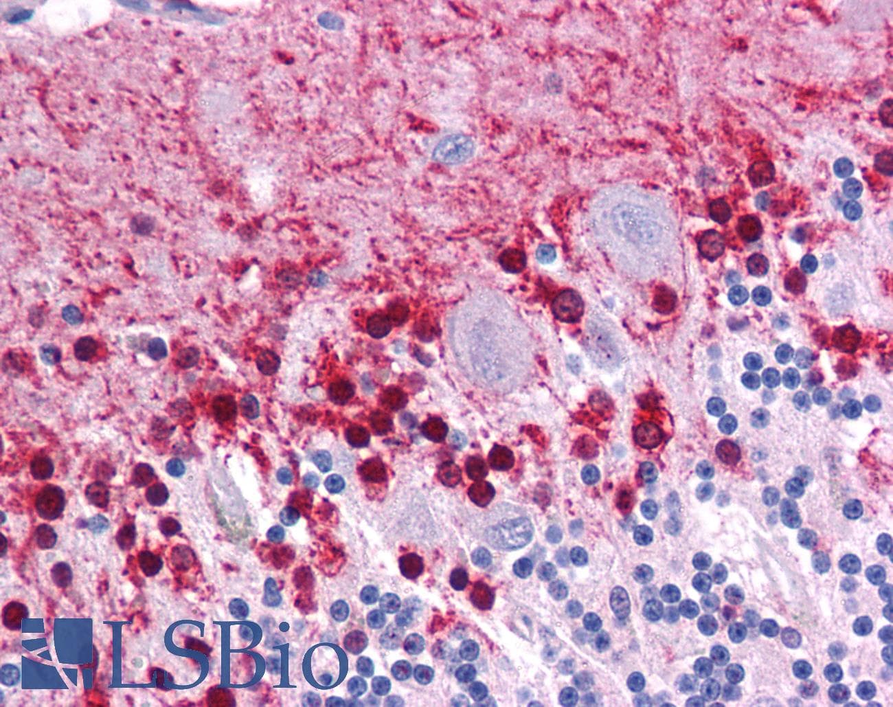 KLF2 Antibody (aa216-265)