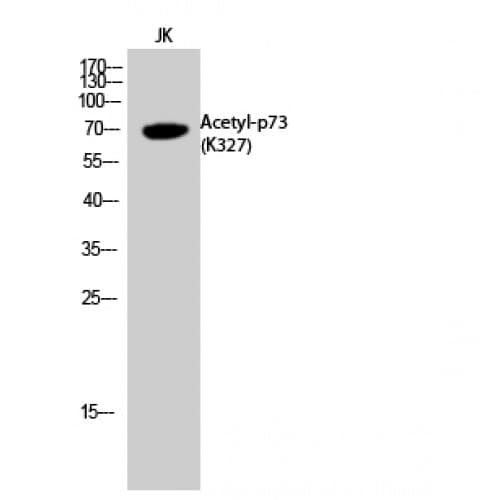 TP73 / p73 Antibody (acetylation site of K327.)