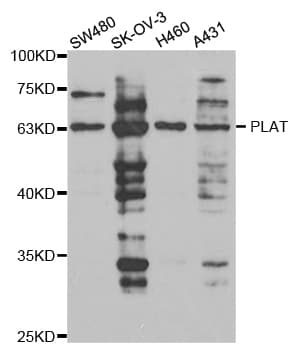 IHC-plus™ Polyclonal Rabbit anti-Human PLAT / TPA Antibody (IHC, WB)