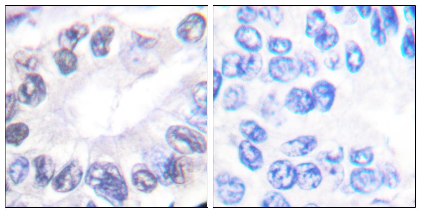 Polyclonal Rabbit anti-Human PRKDC / DNA-PKcs Antibody (IHC)