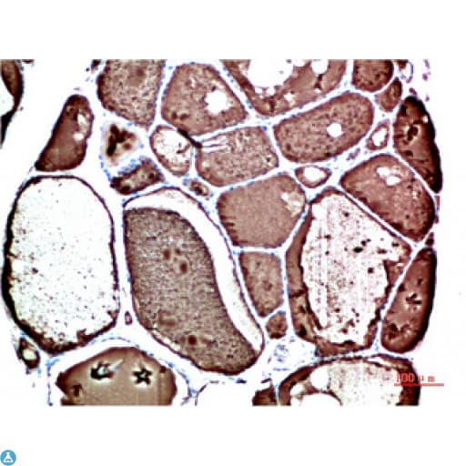 TTR / Transthyretin Antibody