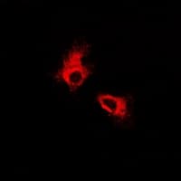 FOXO3 / FOXO3A Antibody