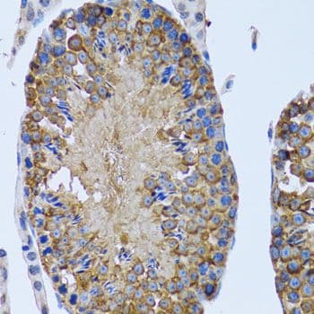 Polyclonal Rabbit anti-Human GCN2 Antibody (IHC, IF, WB)