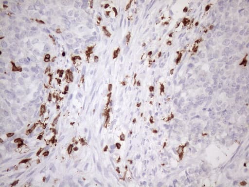 URP2 / FERMT3 Antibody (aa259-528, clone OTI3C7)