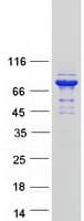Human GFPT2 Protein (Recombinant Myc-DDK (Flag))