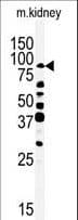 RIP4 / ANKRD3 Antibody (aa802-832)