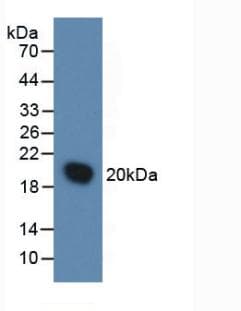 Mouse IL1RN Protein (Recombinant His, N-Terminal)