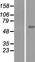 ZNF649 Protein (Over-Expression Lysate Myc-DDK (Flag))