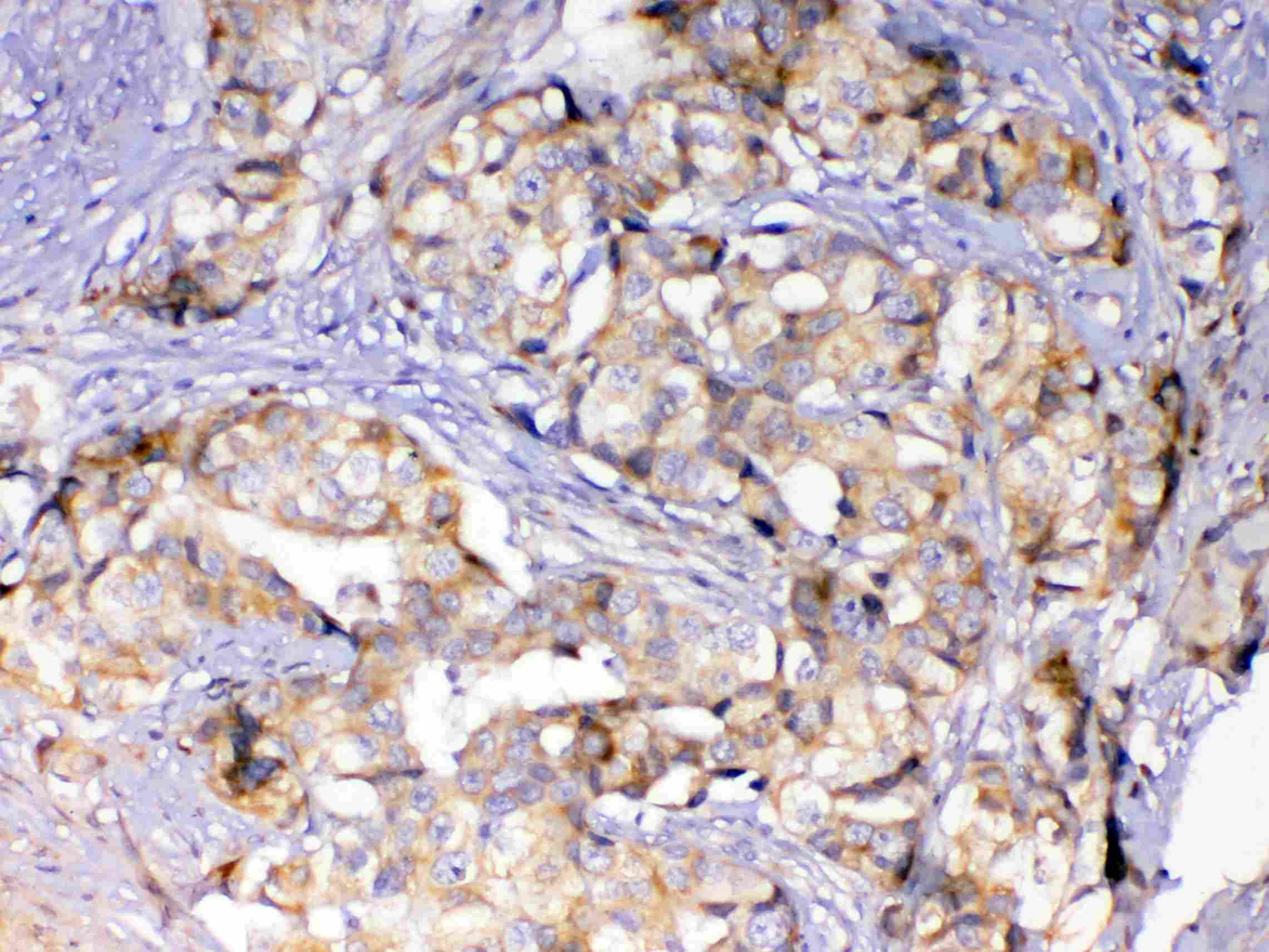 ASL / Argininosuccinate Lyase Antibody