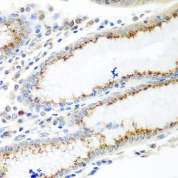 TERE1 / UBIAD1 Antibody