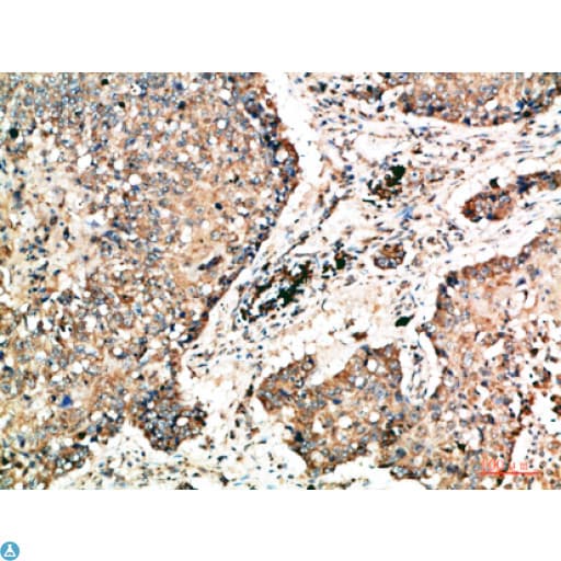 NAPSA / NAPA / Napsin A Antibody