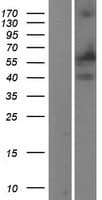 PTGS1 / COX-1 Protein (Over-Expression Lysate Myc-DDK (Flag))
