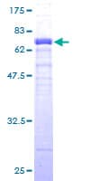 Human FBXO4 / FBX4 Protein (Recombinant GST)