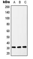 SLC39A9 Antibody (Internal)
