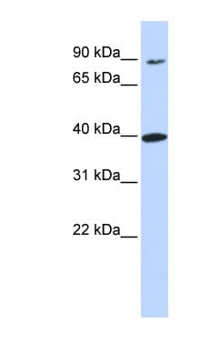 Polyclonal Rabbit anti-Human OR11H12 Antibody (N-Terminus, WB)