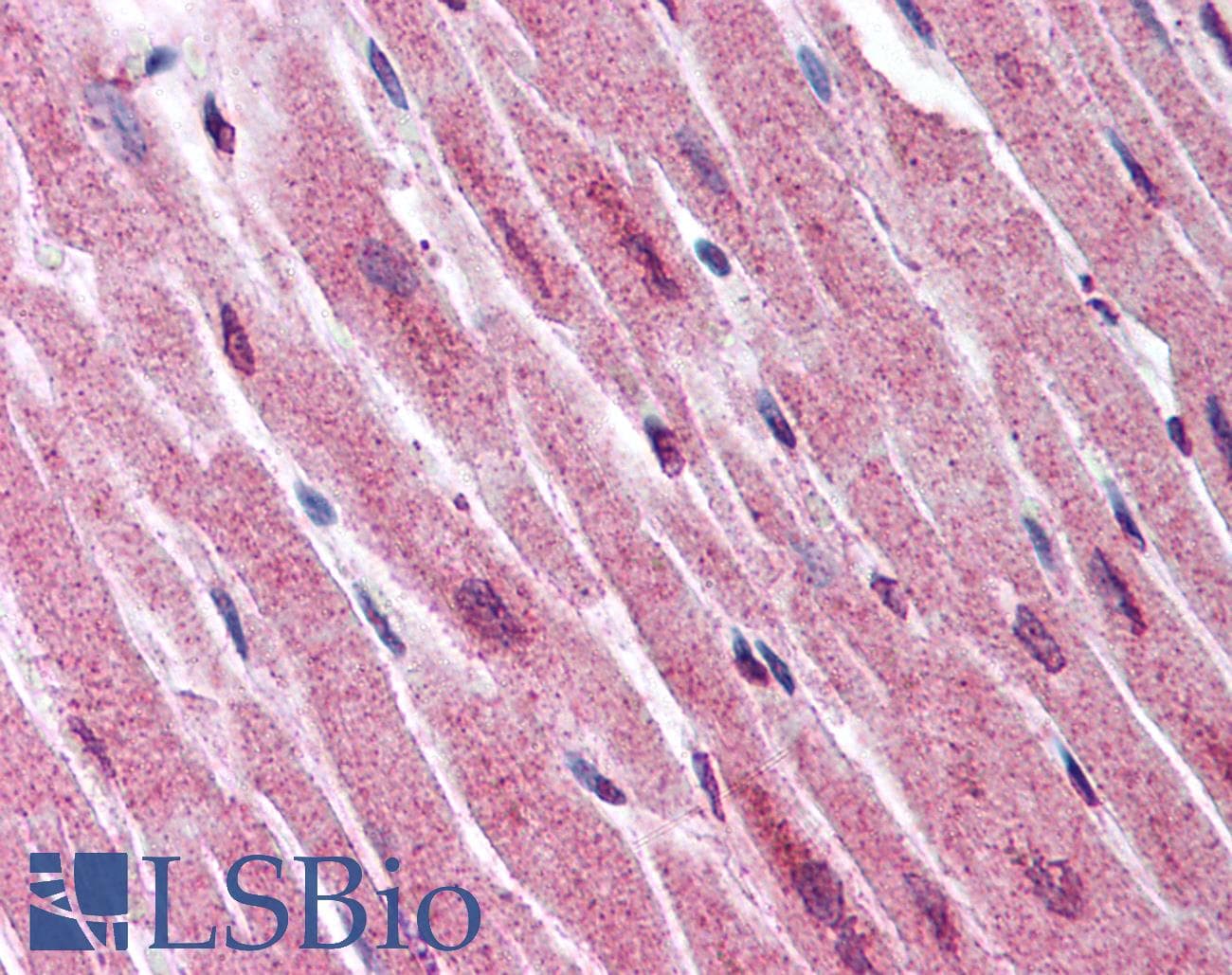 IHC-plus™ ADAMTS4 Antibody (Internal)