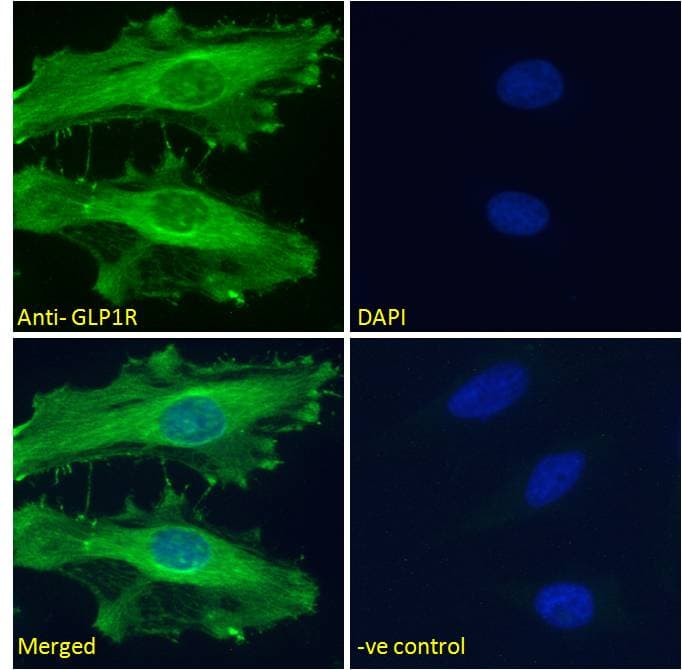 GLP1R / GLP-1 Receptor Antibody (aa211-222)