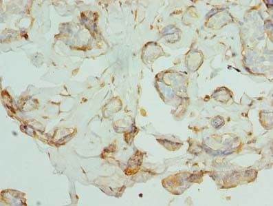 PKD1L2 Antibody