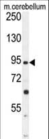Polyclonal Rabbit anti-Human GABBR2 / GABA B Receptor 2 Antibody (aa861-890, IHC, WB)