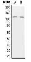 HRS / HGS Antibody (Internal)