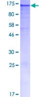 Human DSG1 / Desmoglein 1 Protein (Recombinant GST)
